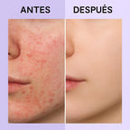 Serum de Centella Asiática
